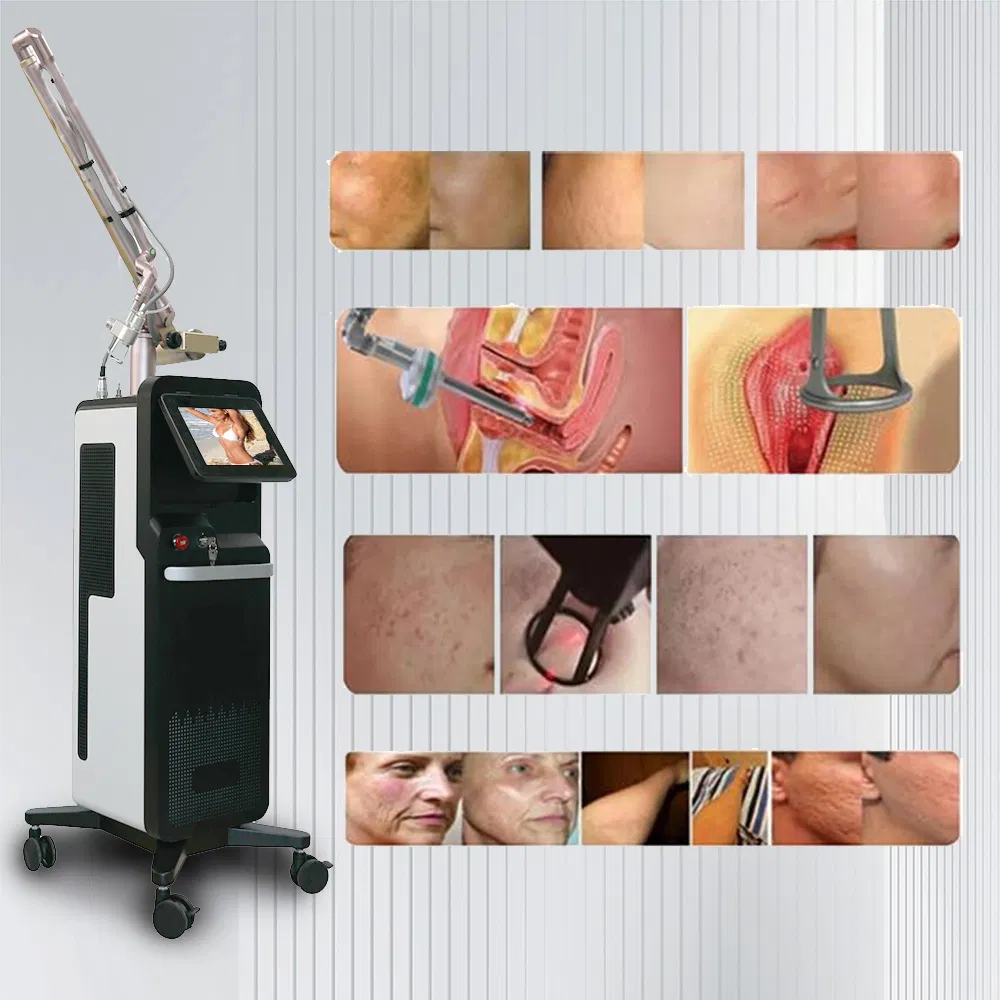 Top Quality Vaginal Tightening Fractional CO2 Laser Cutter Marking Acne Treatment Fractional Laser Machine with CE