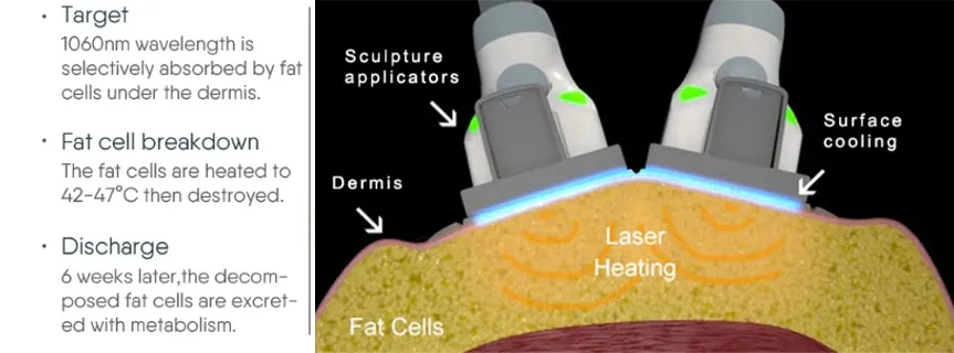 Application Treatment Areas