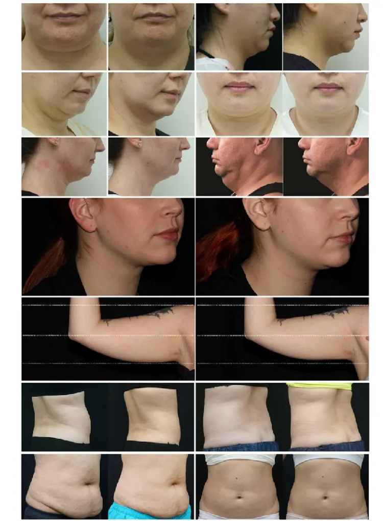 Professional Equipment