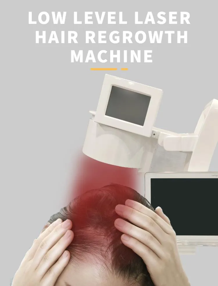 Laser Hair Growth 1