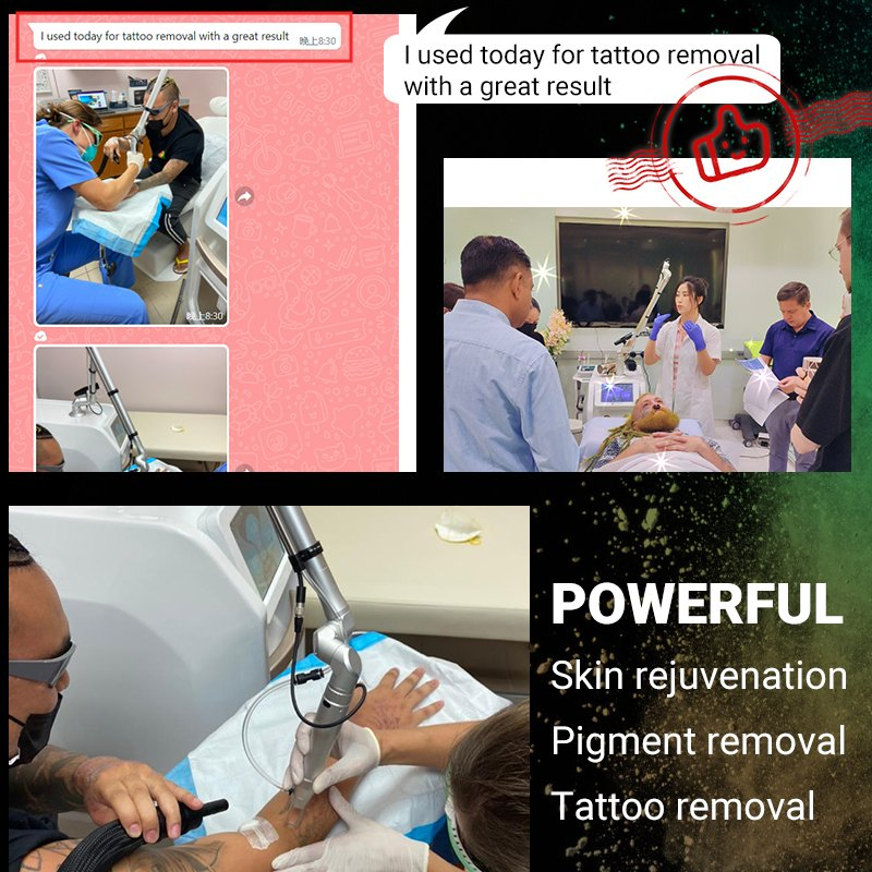 Professional Picosecond Laser Machine Q Switched ND YAG Laser Tattoo Removal