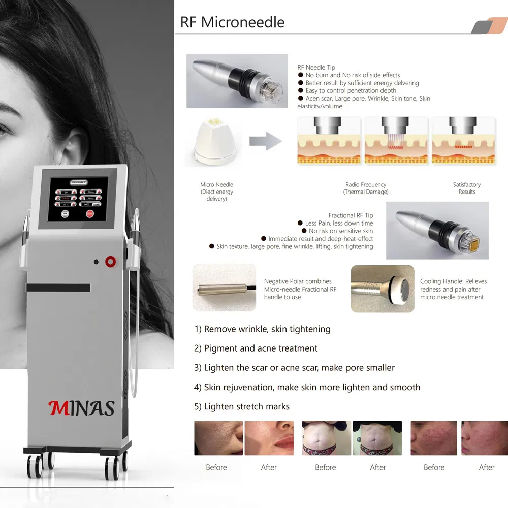 Minas Professional Microneedling Machine RF Winkonlaser Fractional Radio Frequency Equipment