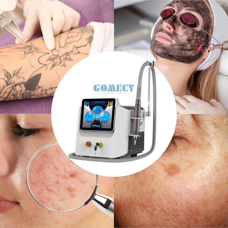 Professional ND YAG Q Switched Laser Machine for Tattoo and Pigment Removal