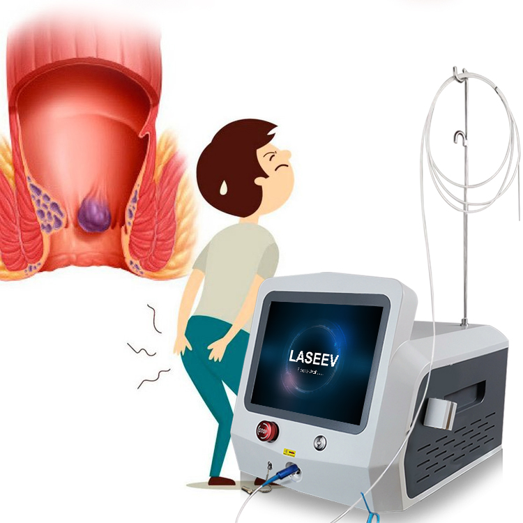 30W 17W Latest Technology Multi-Functions Diode Laser 1470nm 980nm Anal Fistula Surgery Laser Treatment / 1470nm Hemorrhoids Laser