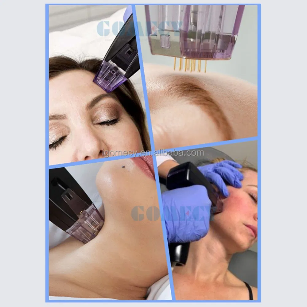 Top Seller Radio Frequency RF Microneedling Machine M8