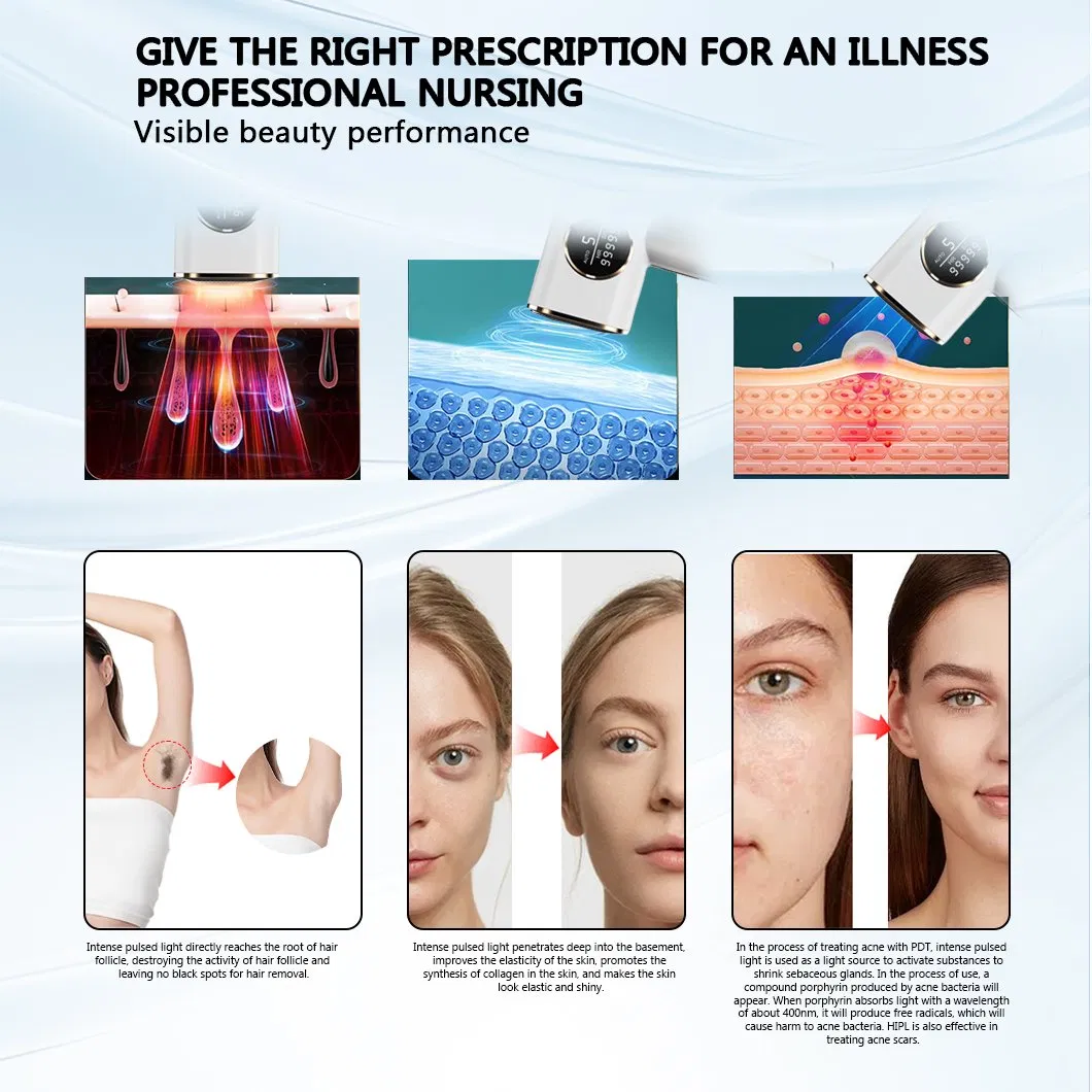 Permanently Home Use IPL Ice Cooling Painless Laser Hair Removal Device