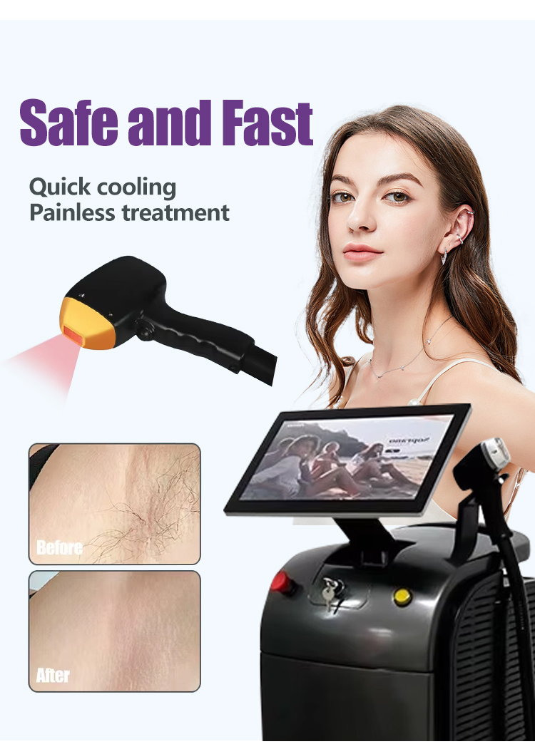 Advanced Vertical Diode Laser Hair Removal System with Ice Cooling with 755nm/808nm/1064nm Technology Diode Laser Hair Removal Device for All Skin