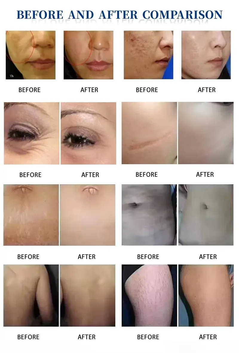 Before and After Results