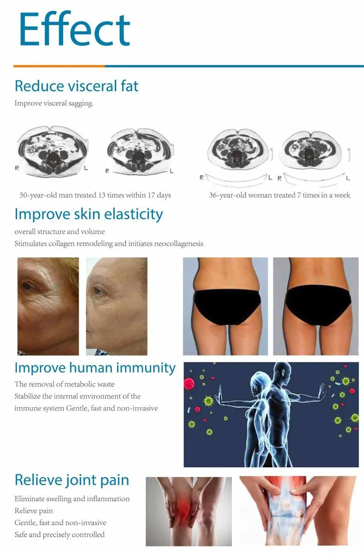Before and After Results