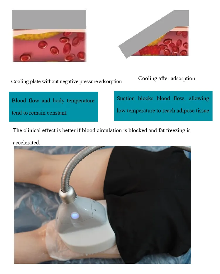 Weight Loss Solution