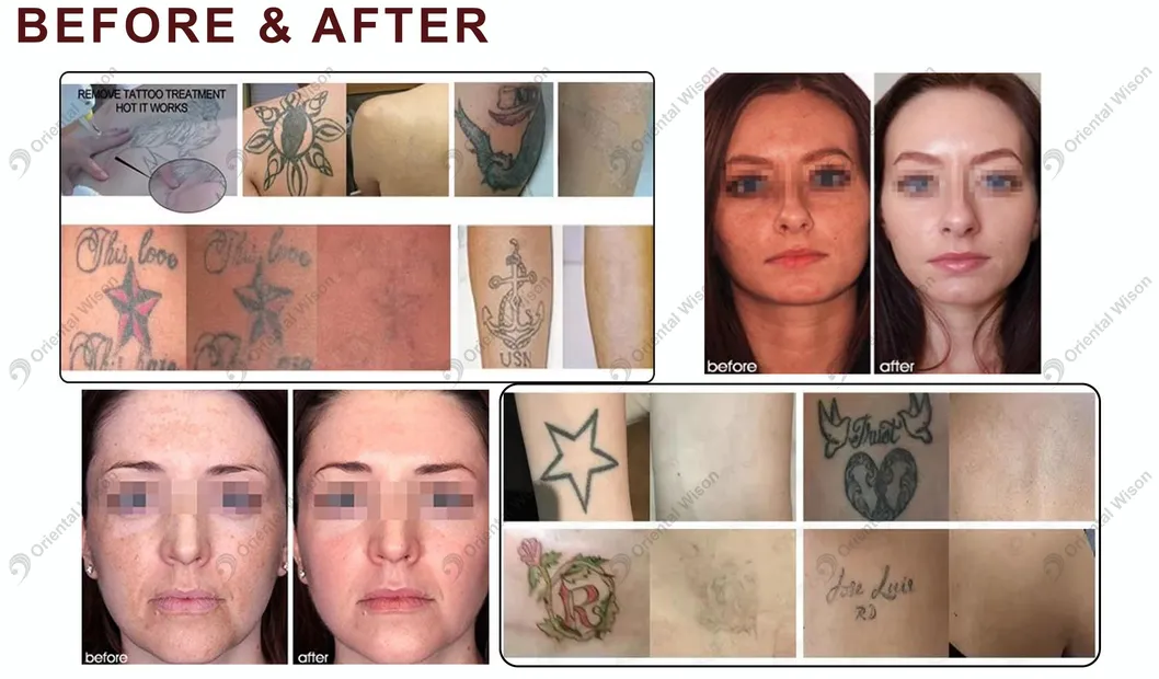 Before and After Results