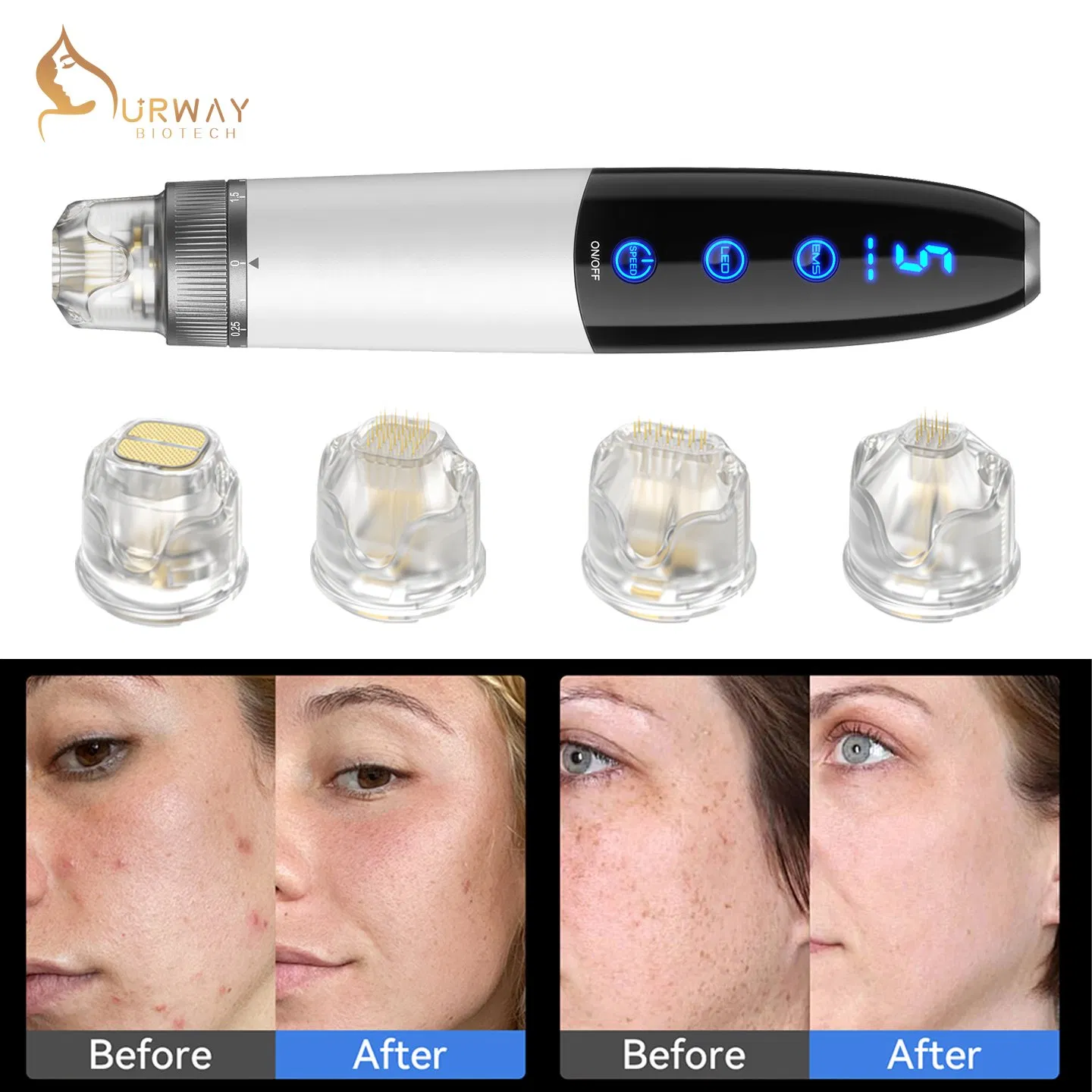Micro Needle Pen Q1s Microneedling Facial Removes Acne Scars