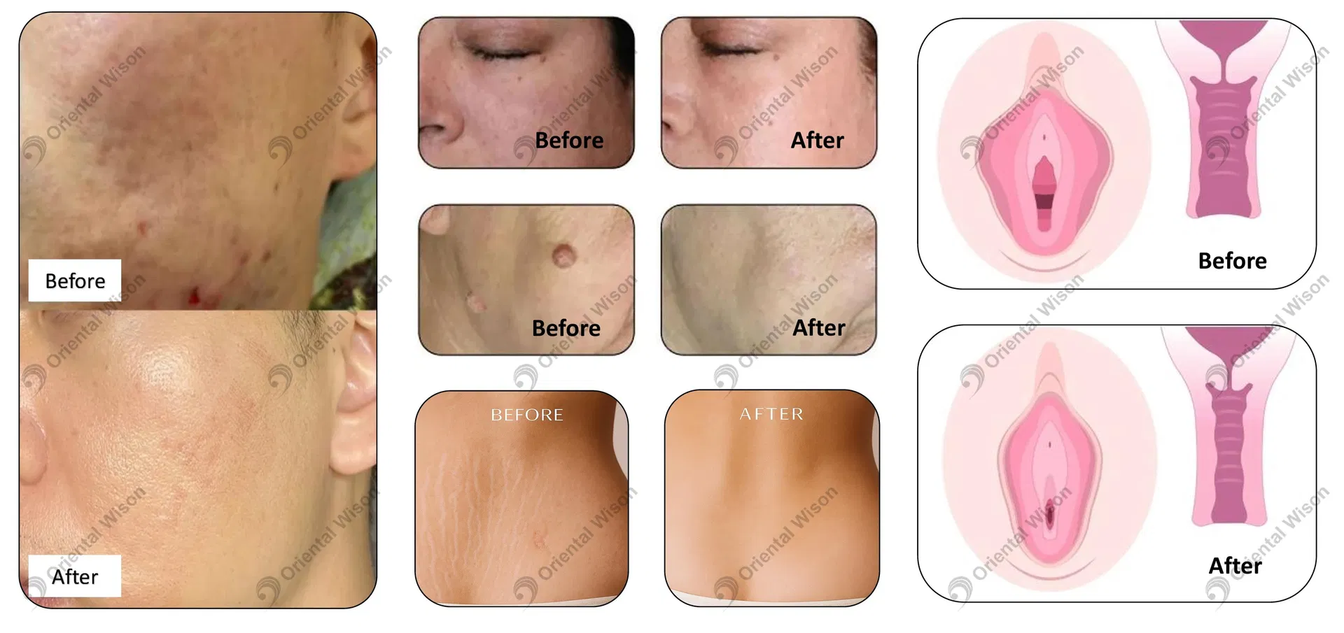 Before and After Results