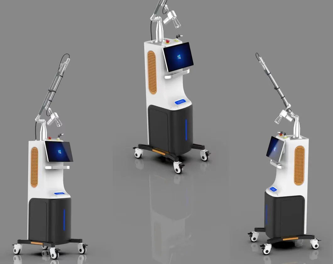 Laser Machine Overview