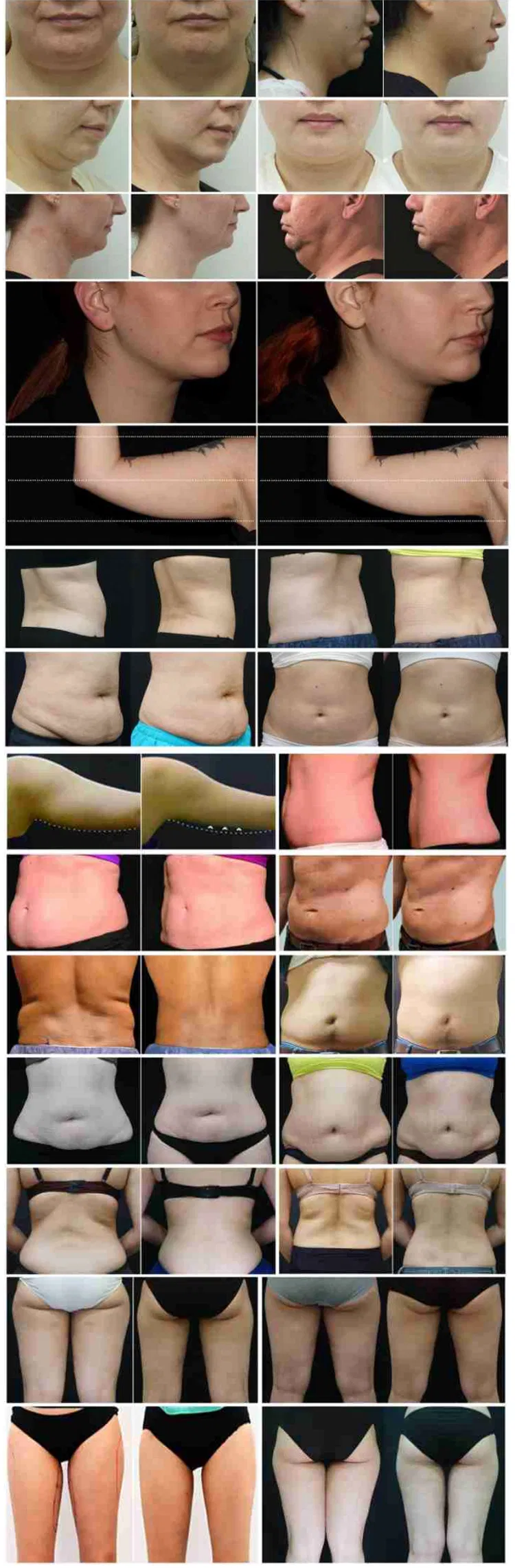 Professional Results