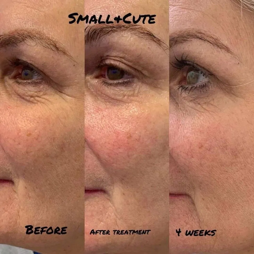 Customer Feedback Results