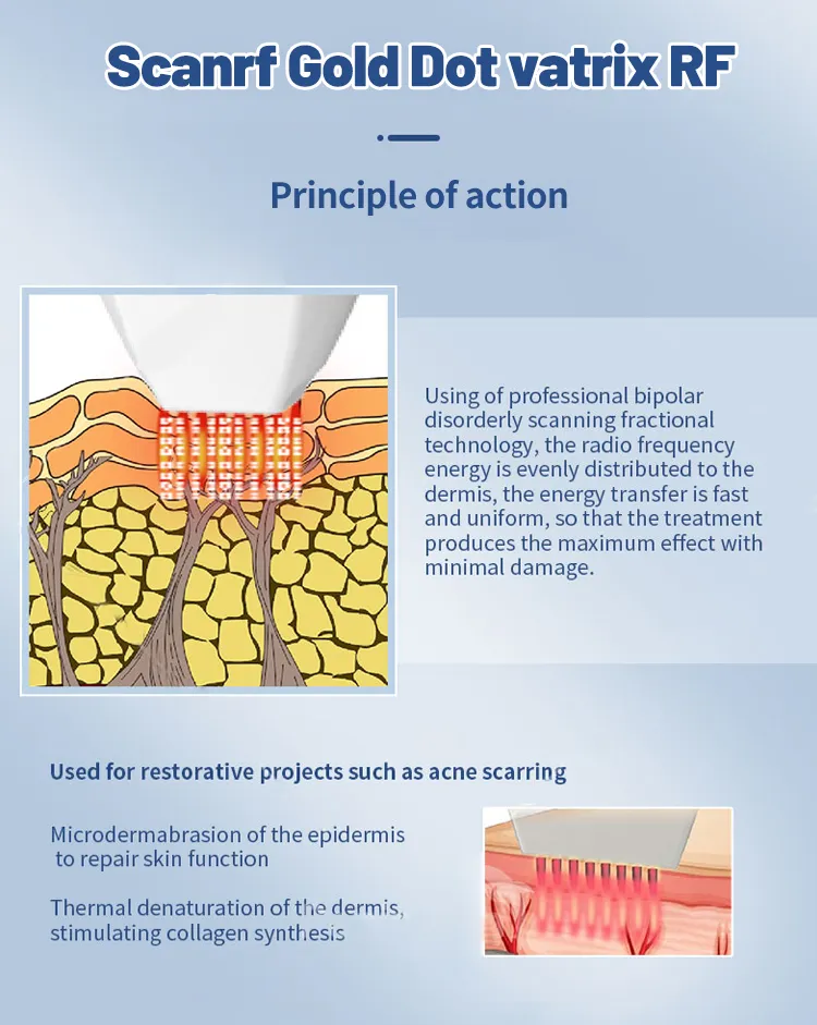 RF Golden Microneedling 5
