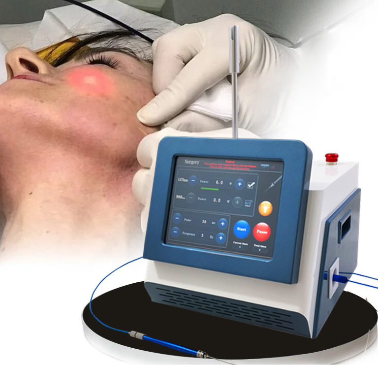 980nm 1470nm Diode Laser Varicose Veins Treatment Fat Reduction Liposuction Machine D Laser 1470 Visage