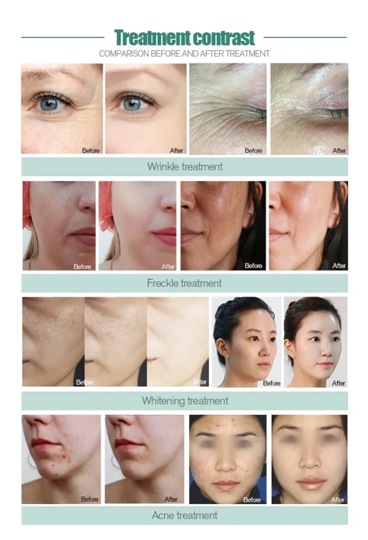 Professional Beauty Machine