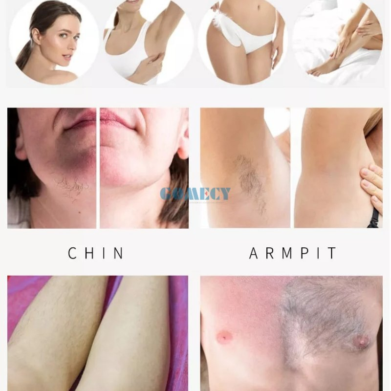 Luxury Diode Laser Hair Removal Device with Sapphire Cooling Technology