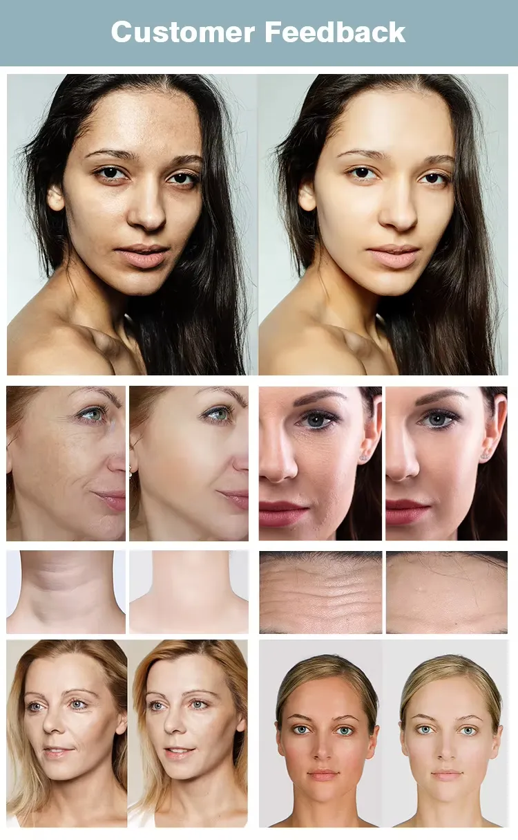 Smart Eye Massager Detail 10