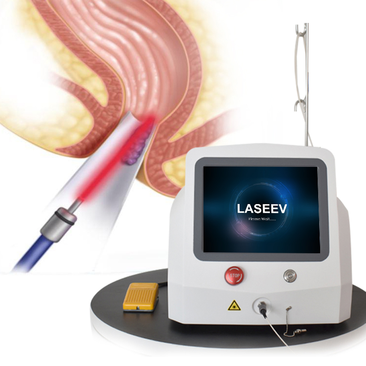 Newest 980nm 1470nm Hemorrhoids Fistula Treatment Diode Laser Medical Technology