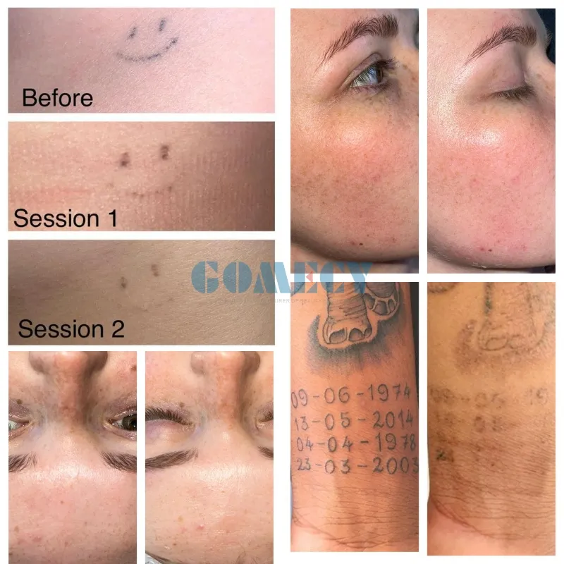 Laser Machine View 2