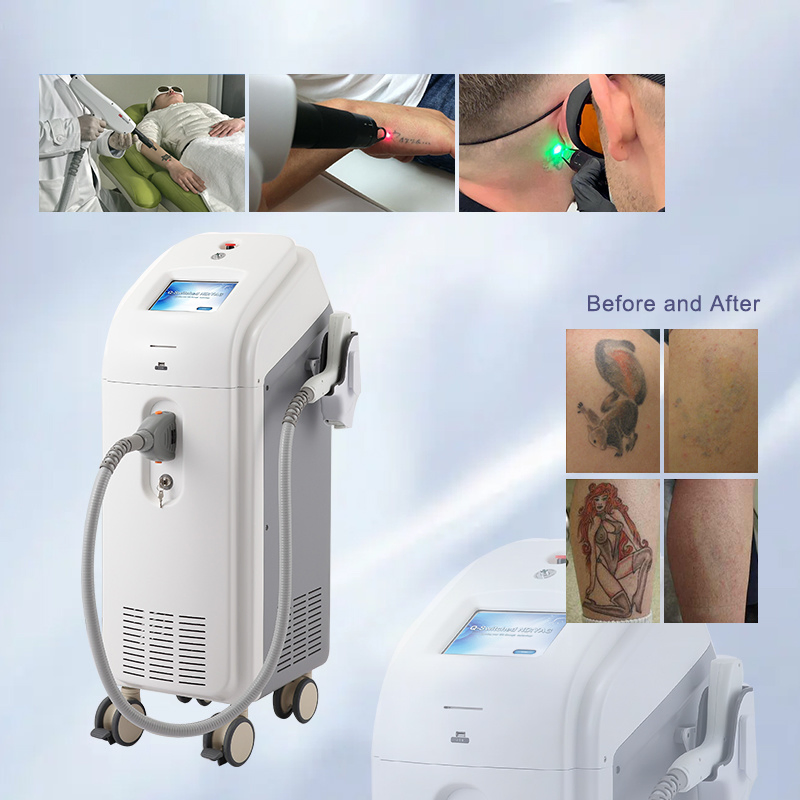 ND YAG Laser Dermatology Equipment Q-Switch ND YAG Laser Equipment Tattoo Removal and Skin Toning