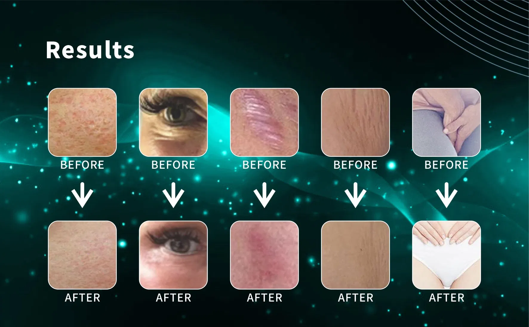 60W FDA CO2 Fractional Laser Portable Skin Tightening Whitening Scar Remover Features Acne Removal Vaginal Tightness Treatment