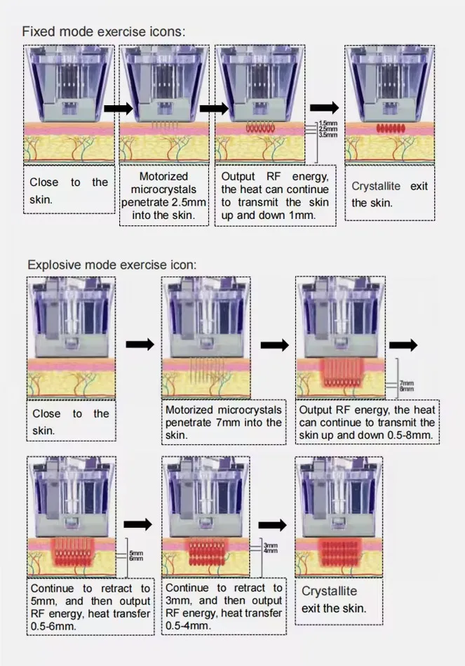 Working Mechanism 1