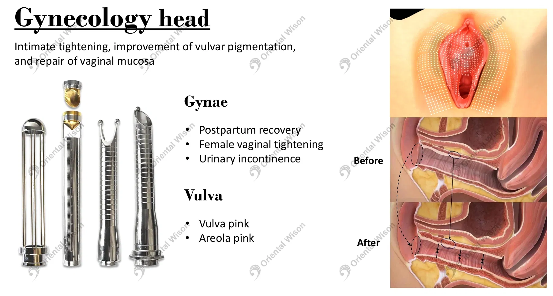 Gynecology Advantages