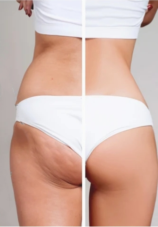 Cryolipolysis 360 Beauty Machine - 2-in-1 Flat Cryolipolysis Cryo Fat Freezing for Body Slimming Equipment