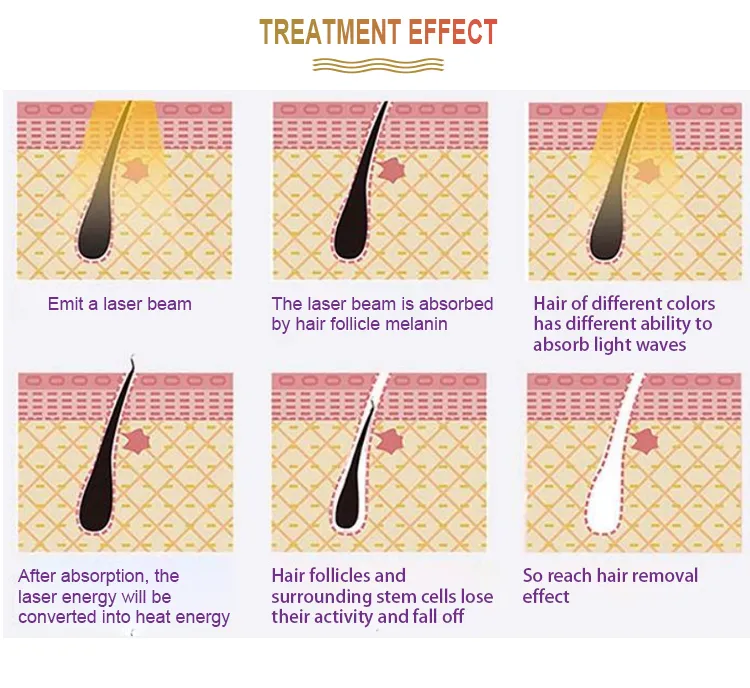 Treatment Handle