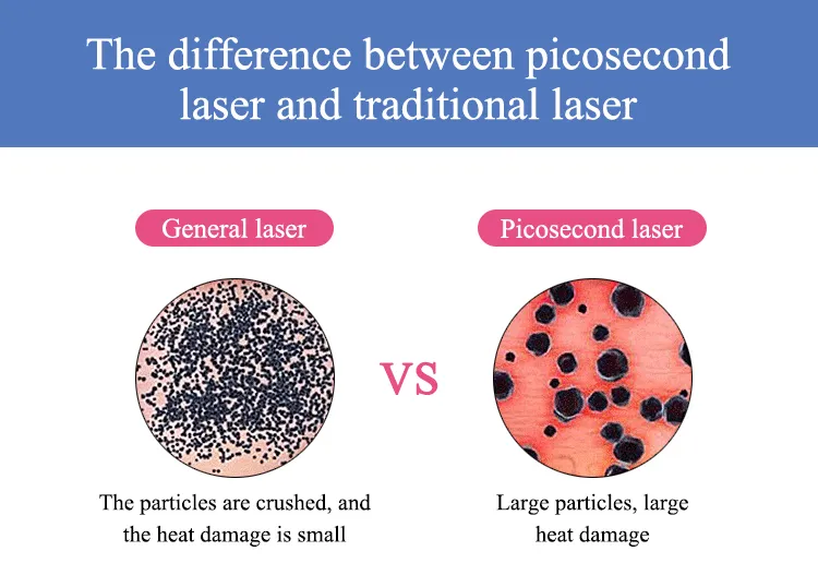 Pico Laser Machine