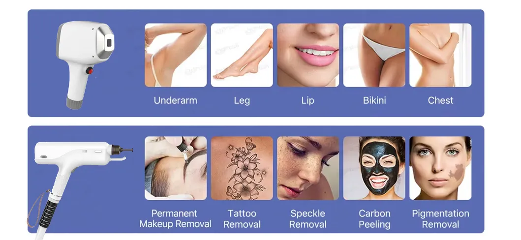 3-in-1 Laser Machine Overview