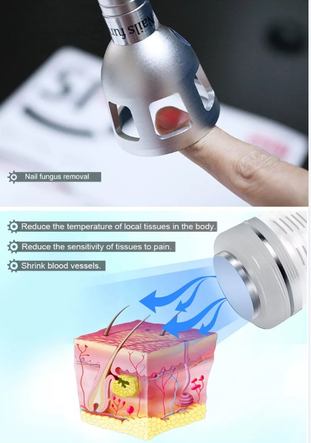 Multiwave System Portable Laser Physiotherapy Diode Laser 980nm Treatment