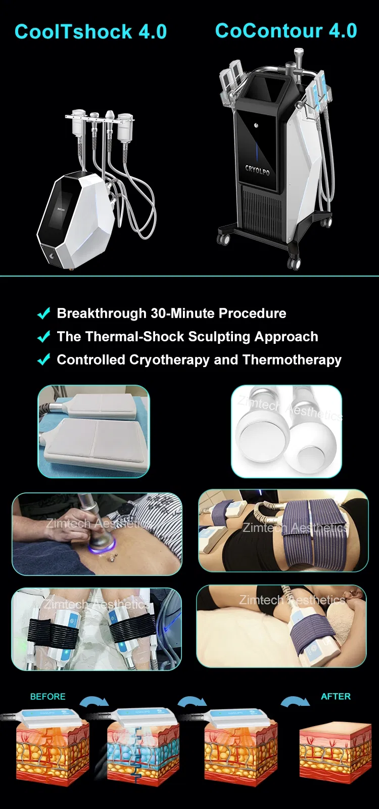 Cryoskin 4.0 Drainage