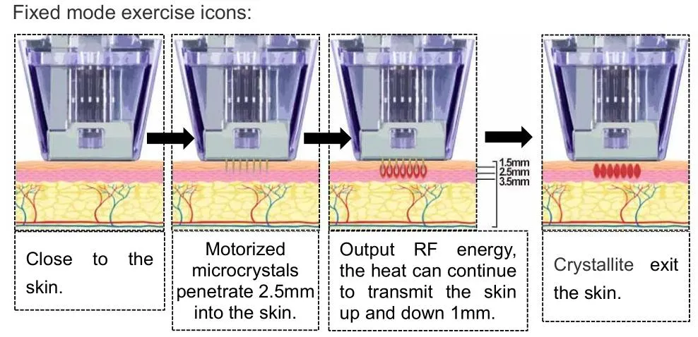 Treatment Depth Visualization