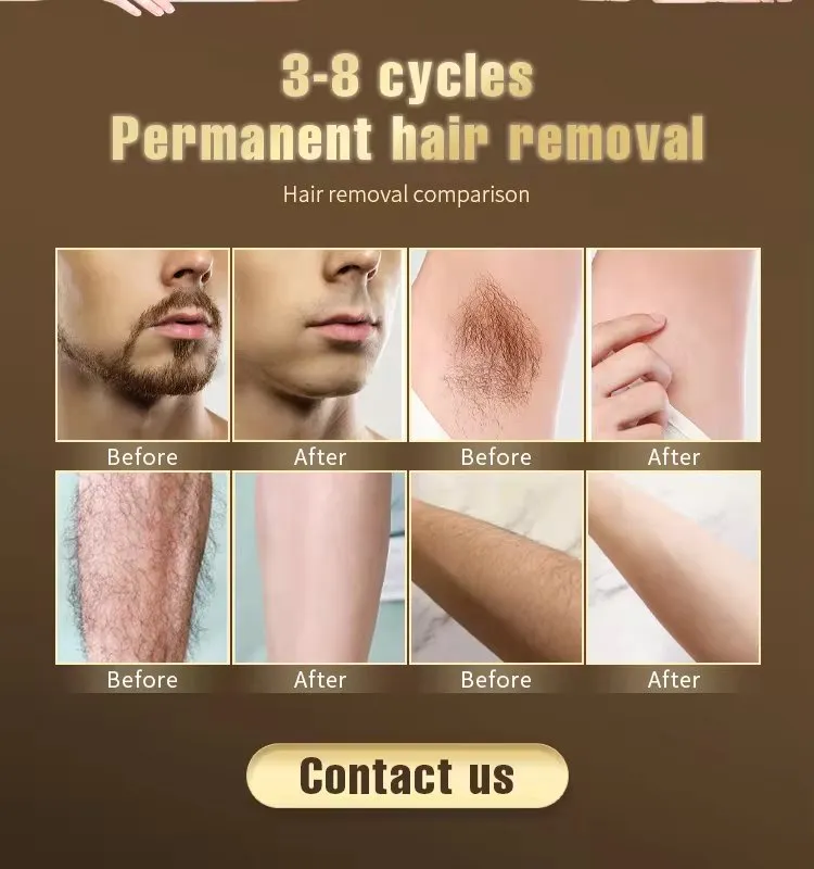 Treatment Performance