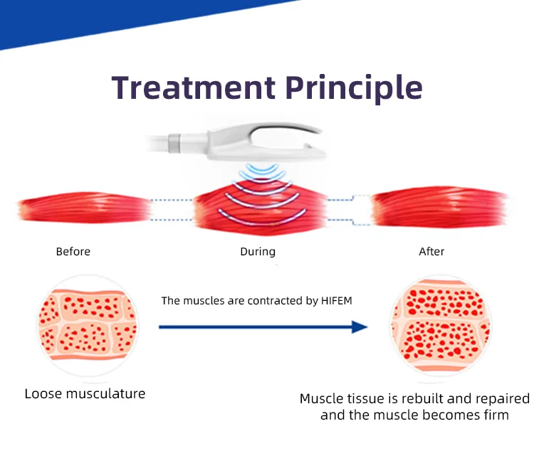 Training Fitness Slimming