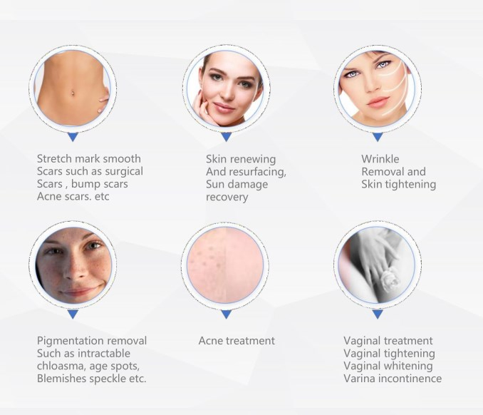 Fractional CO2 Laser Vaginal Tightening Machine Skin Whitening CO2 Laser Stretch Marks Removal Machine