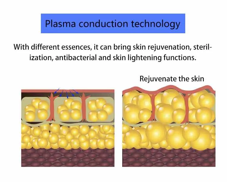 Plasma treatment 4