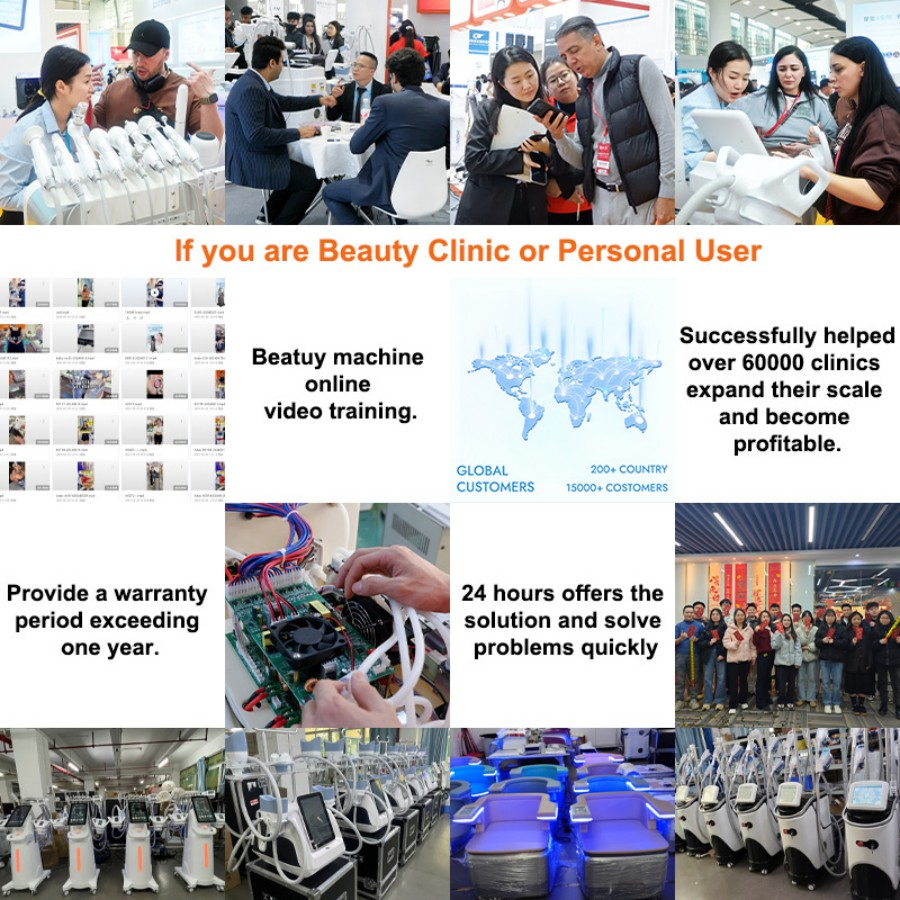 Professional 7D Hifu Machine Face Lifting Remove Neck Wrinkles Anti Aging 7D RF Microneedling Hifu Machine