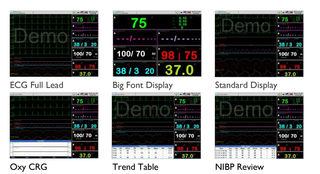 F5 Monitor 2