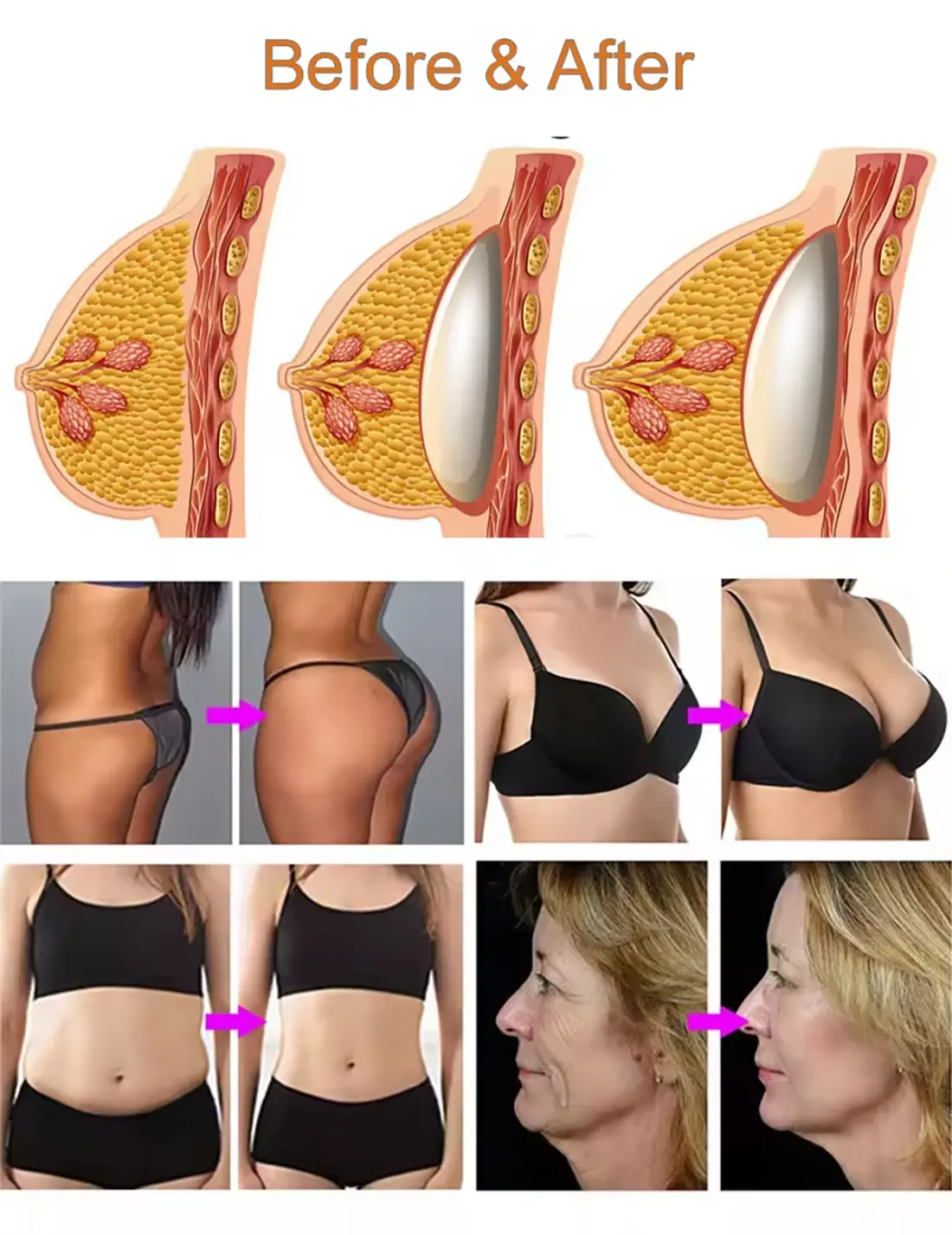 Breast enlarge machine-7