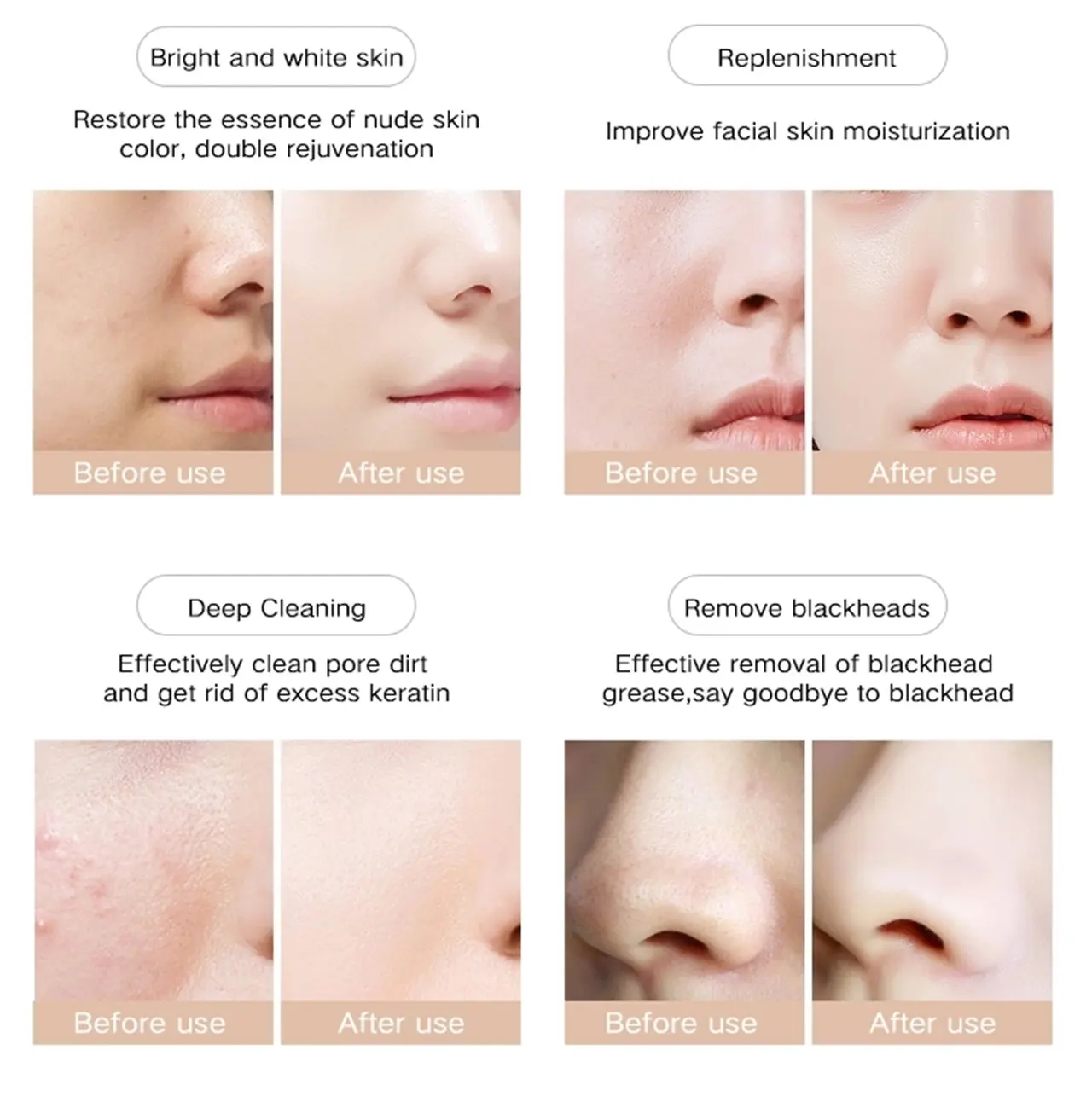 Microdermabrasion Machine Display 6