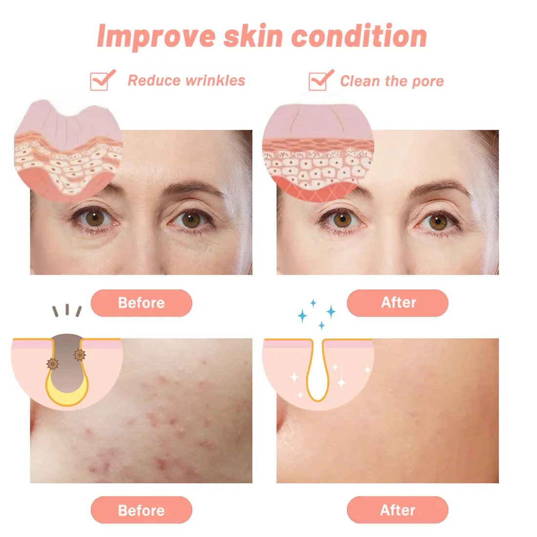 7 colors LED beauty mark5