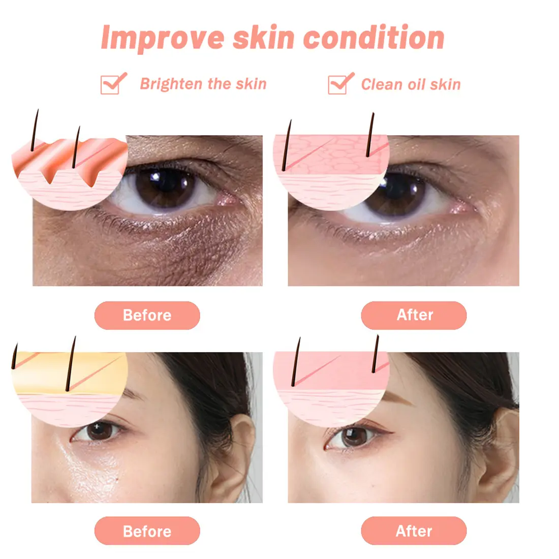 7 colors LED beauty mark4