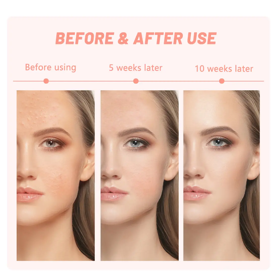 7 colors LED beauty mark