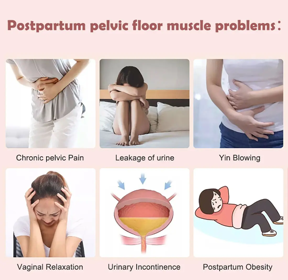 pelvic floor muscle-61i8